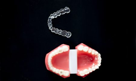 Modern Braces Options for All Ages